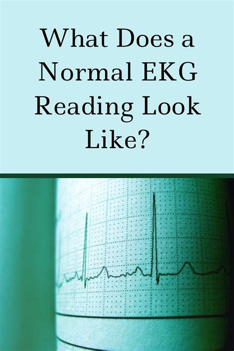 What Does A Normal EKG Reading Look Like Ekg Reading Heart Disease