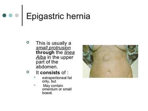 Hernia