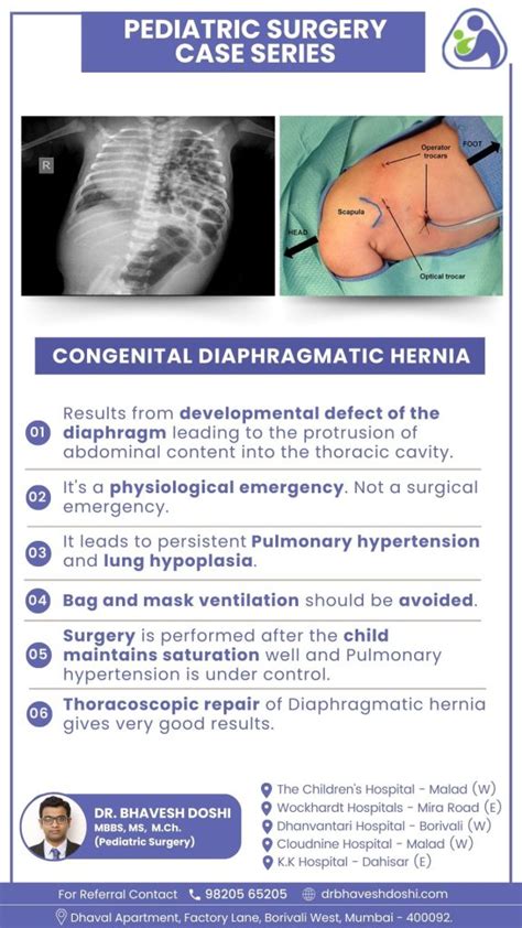 Congenital Diaphragmatic Hernia Cdh