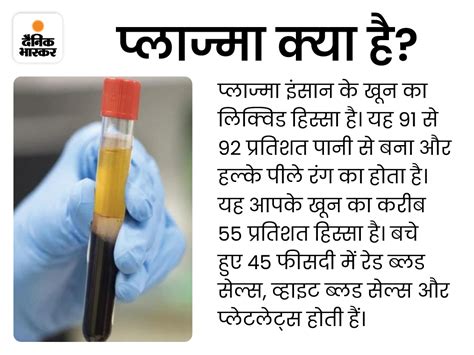 What Does Medical Science Say Know The Reason From The Expert Mp में डेढ़ साल की बच्ची का खून