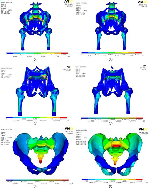 Comparing The Von Mises Stress Displacement And Stress Vector Download Scientific Diagram