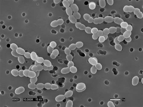 Gram Con Bajo Contenido En G C Firmicutes Molicutes