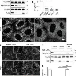 Flcn Controls Tfeb Dependent Regulation Of Lysosomes A Spinning Disk