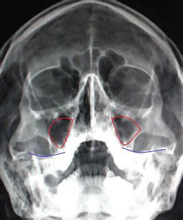 Dicas De Radiologia Tudo Sobre Radiologia Como Avaliar A Qualidade