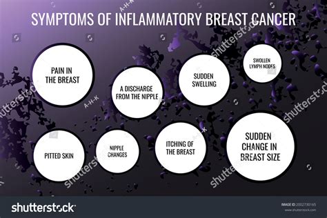 symptoms of Inflammatory breast cancer. Vector - Royalty Free Stock ...