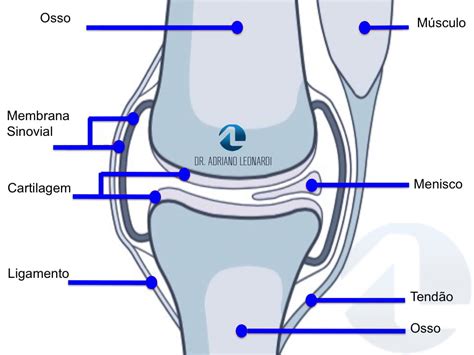 O Que Artrose No Joelho Especialista Do Joelho Dr Adriano Leonardi