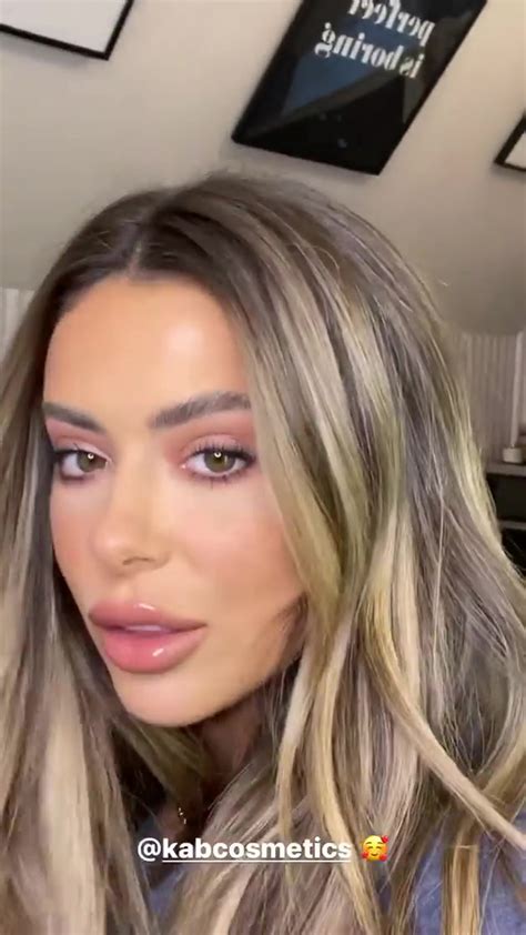 Brielle Biermann Gives Update After Jaw Surgery Rip Butt