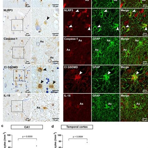 Cell Type Specific Pyroptosis Activation In The MTL Of AD Brain In