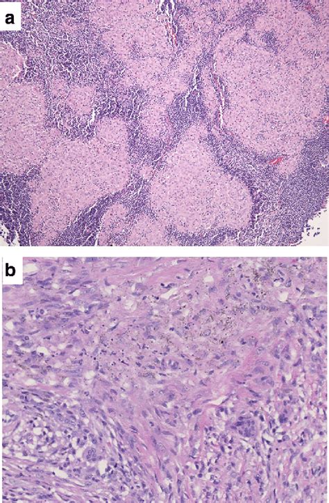 Histology Of Lymph Node