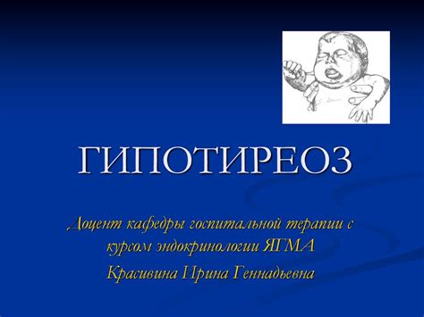 Гипотиреоз. Патогенез гипотиреоза - презентация онлайн
