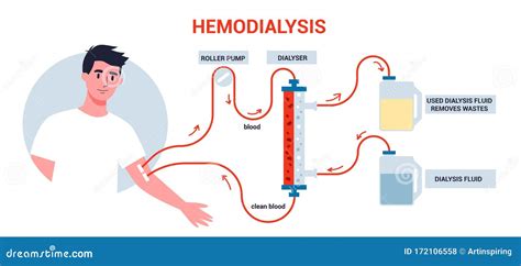 Hemodialysis For Kidney Treatment Man Get A Kidney Disease Vector