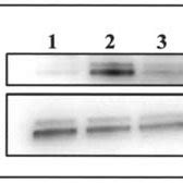 Western Blot Analysis Of ERK Phosphorylation In Ishikawa Cells