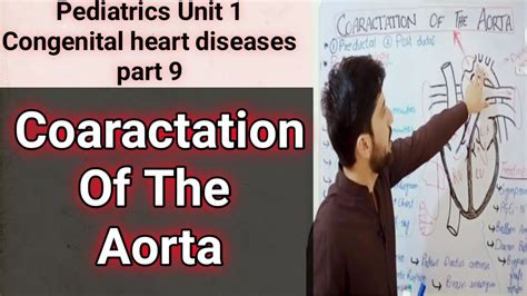 Coarctation Of The Aorta Pre Ductal And Post Ductal Pathophysiology Symptoms And Treatment