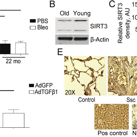 Downregulation Of Sirtuin 3 Sirt3 In Aging And Pulmonary Fibrosis