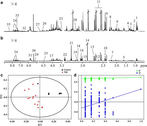 Representative ¹H NMR spectra of urine obtained from APP23 PS45 mice a