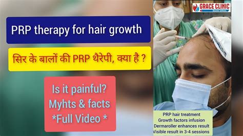 Prp Therapy For Hair Loss Platelet Rich Plasma Therapy 3 Grace