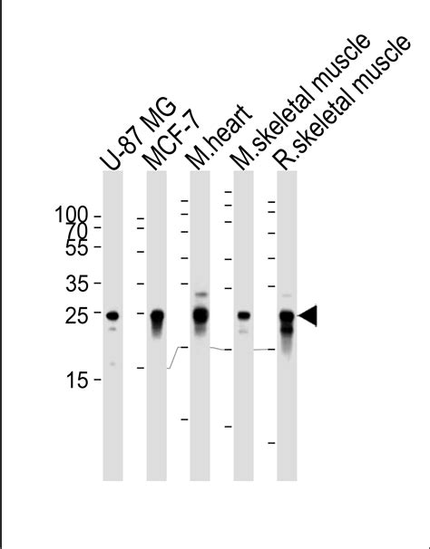 CRYAB Antibody Purified Mouse Monoclonal Antibody Mab WB E Buy