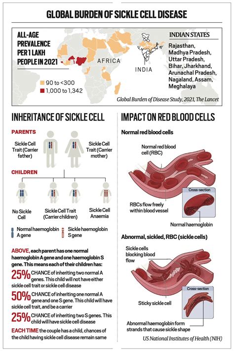 Casgevy: How gene therapy will revolutionize treatment of sickle cell ...