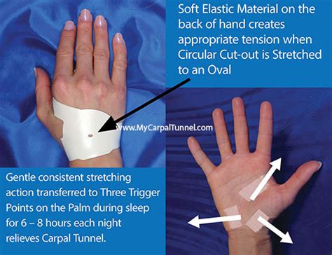 Hand Joint Pain And Pain In Wrist The Carpal Solution