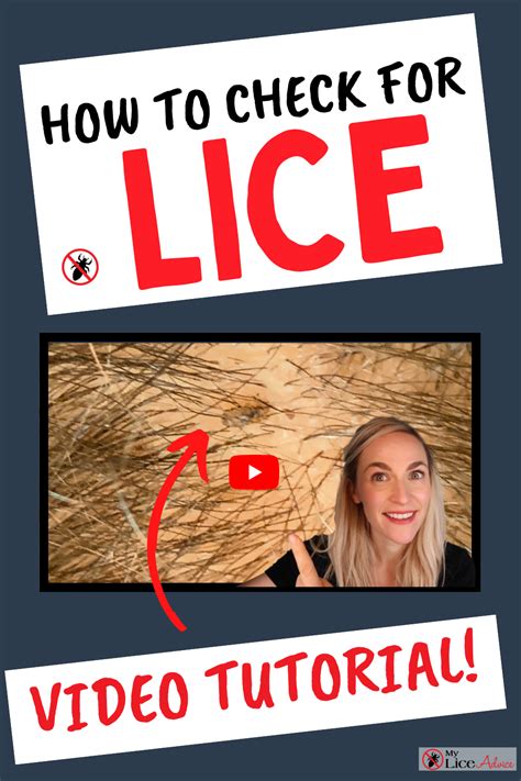 How To Check For Lice Video Tutorial Louse Head Louse Hair Lice