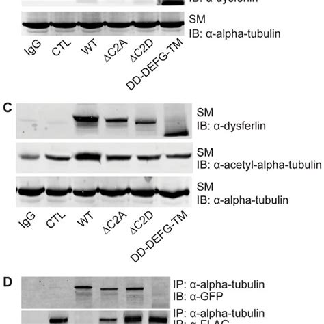 Dysferlin Requires Its Alpha Tubulin Binding Domains To Bind HDAC6 And