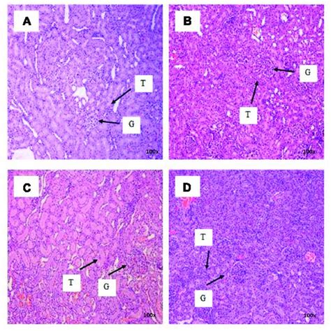 Photomicrograph Of Spleen Sections From Female Rats Treated With L Download Scientific