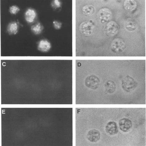 Accumulation Of Acridine Orange In Acidic Vacuoles In Vivo Cells Were