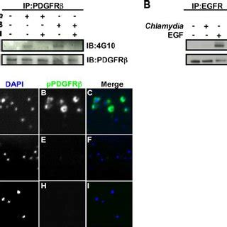 C Trachomatis Infection Induces Phosphorylation Of Pdgfr B And