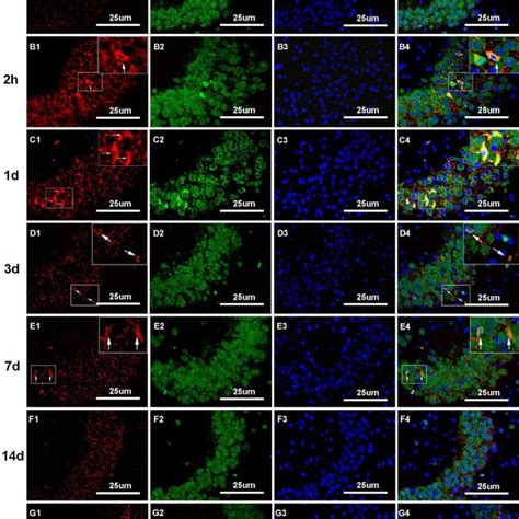 H&E staining in rat hippocampus. (A) The morphological changes of the ... 