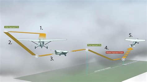 Technique Anatomy Of An Approach Aopa