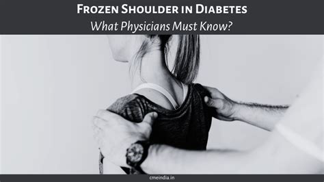 Frozen Shoulder In Diabetes What Physicians Must Know Cme India