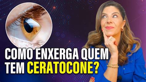 Como Enxerga Quem Tem Ceratocone Youtube