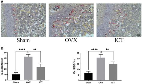 Icaritin Ameliorates Rankl Mediated Osteoclastogenesis And Ovariectomy