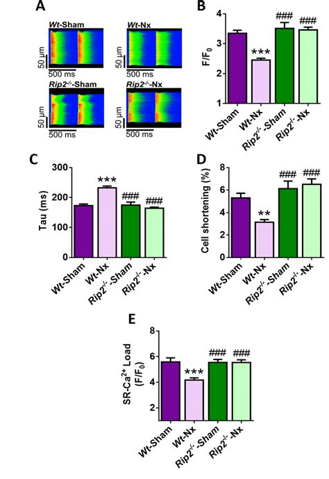 Deficiency Of Receptor Interacting Serine Threonine Protein Kinase