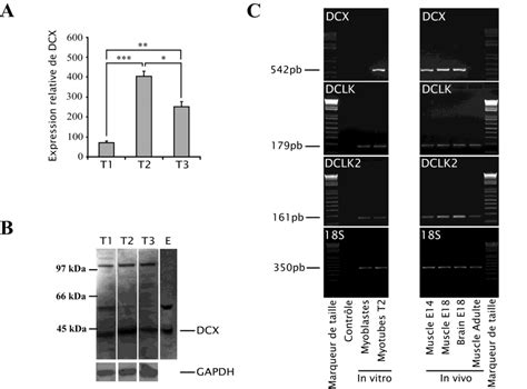 Expression de la DCX au cours du développement musculaire A