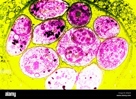 Transmission Electron Microscope Color Enhanced Image Of Toxoplasma Gondii Cysts From Cdc Stock