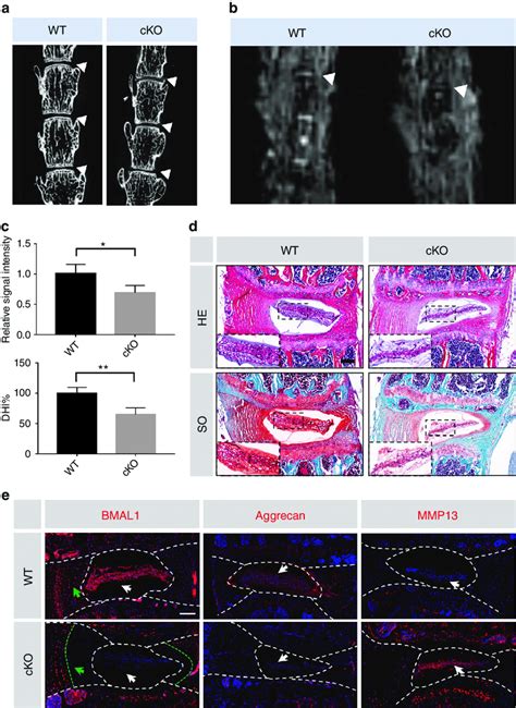 Deletion Of Bmal1 Leads To The Degradation Of ECM In NP Tissue A