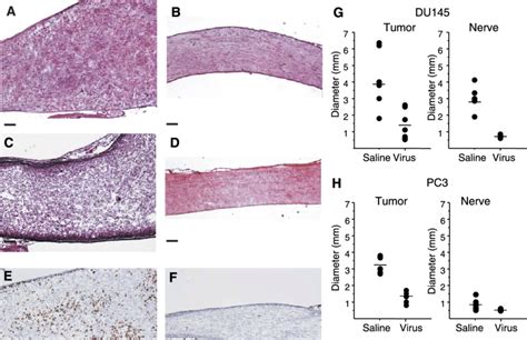 Representative Histopathologic Photomicrographs Of Tumors Treated With