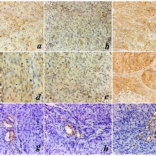 Representative Images Of Immunohistochemistry Staining Eight Weeks