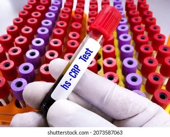 Blood Sample Tube Hs Crp Test Stock Photo 2073587063 Shutterstock