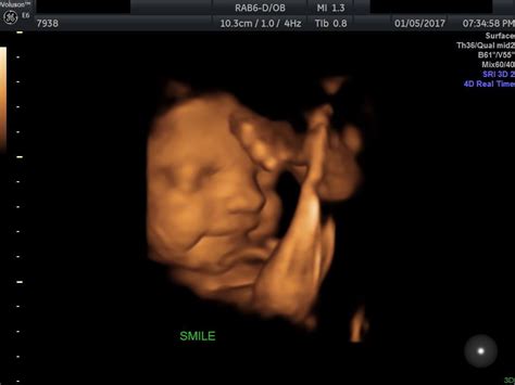 My husband wanted to do a 3D ultrasound. Baby loved OJ so much he ...