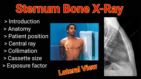 Sternum Bone X Ray Lateral View Patient Position By BL Kumawat