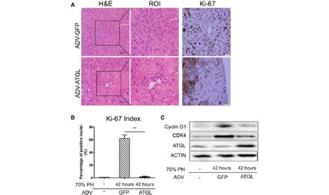 Atgl Overexpression Inhibits Hepatocyte Proliferation And Promotes