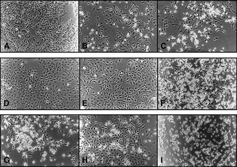 Phase Contrast Microscopy Analysis After Anti Fas Ab Ifn And Download Scientific Diagram