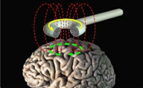 Magnets To The Brain Can Change Peoples Views On Immigrants And God