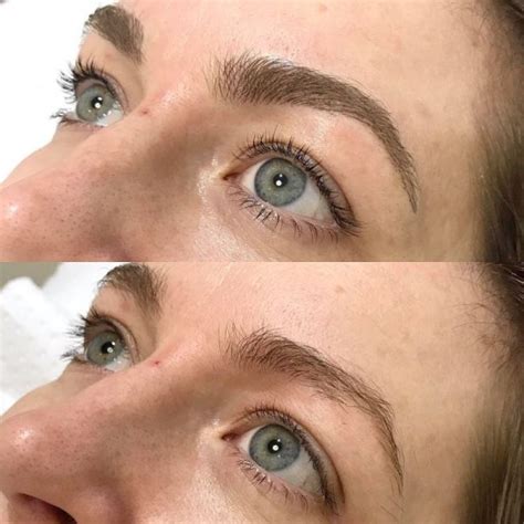 Eyebrow Feathering Gallery | Eyebrow Feathering Before and Afters