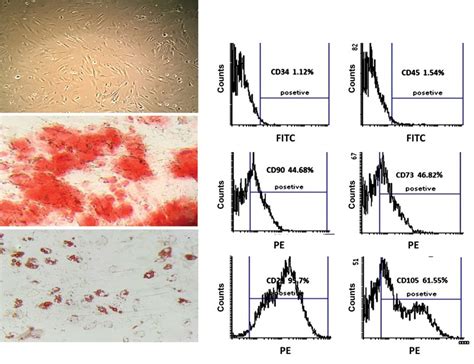 Characterization Of Adipose Derived Mesenchymal Stem Cells AD MSCs