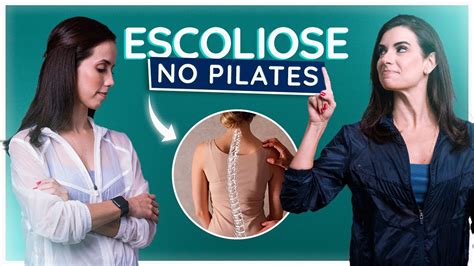 Os principais EXERCÍCIOS para tratar ESCOLIOSE no PILATES YouTube