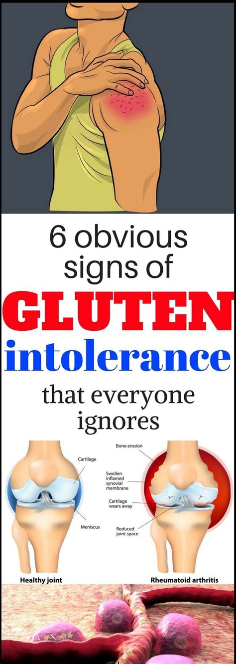 Gluten Sensitivity Is Quite Common These Days Those Who Are Sensitive