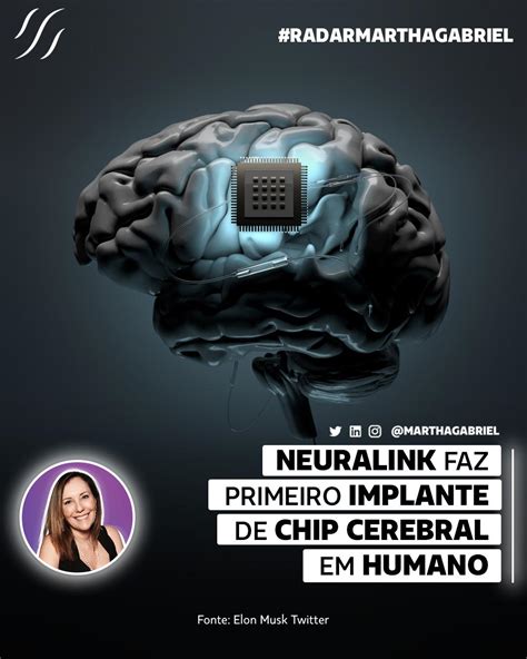 Neuralink Faz Primeiro Implante Cerebral Em Humano Futuro Dos Neg Cios